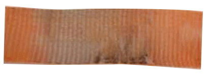 Abrasión